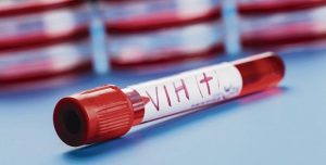 2019: EL AÑO DE LA VACUNA CONTRA EL VIH